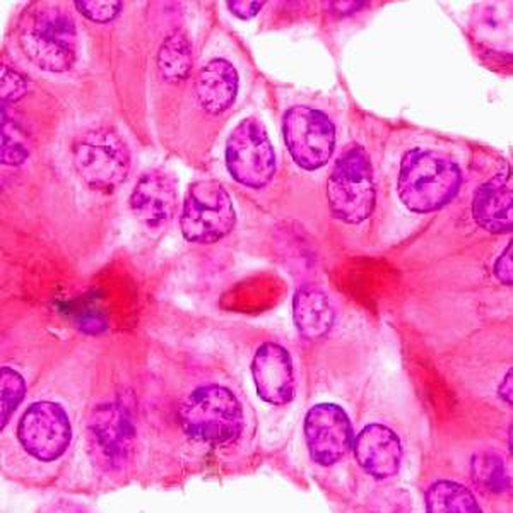 Papanicolaou orange polychromatique