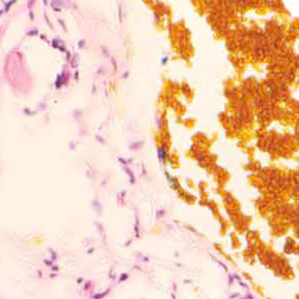 Colorant indélébile orange