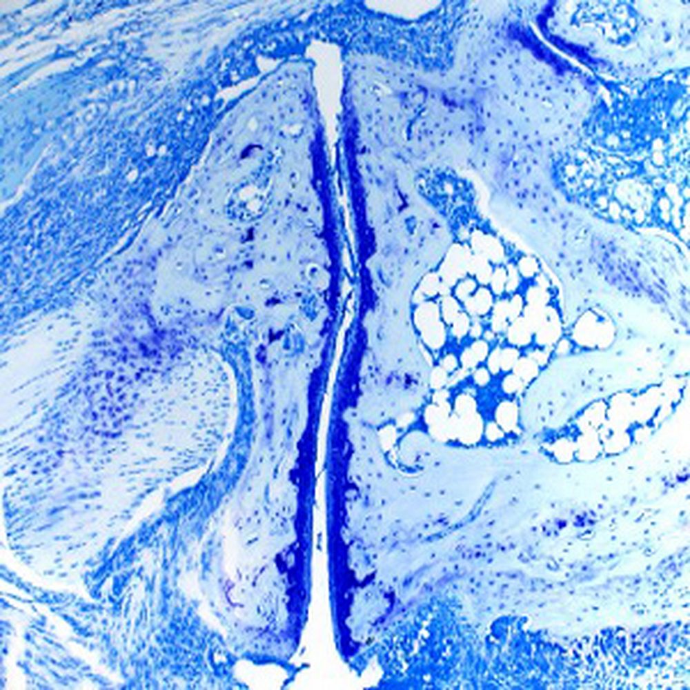 Bleu de Toluidine polychrome