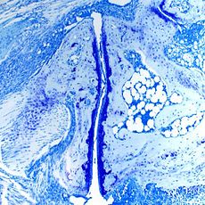 Bleu de Toluidine polychrome