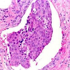 Erythrosine B