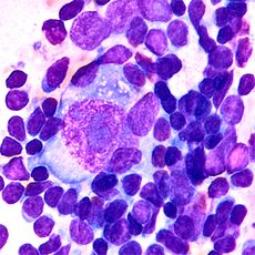 Giemsa rapide en solution concentrée pour la microscopie