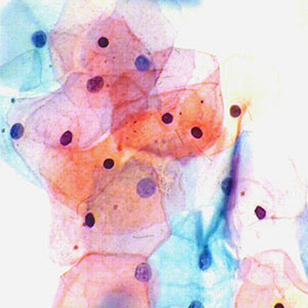 Solution de Papanicolaou EA31&nbsppolychrome