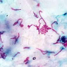 Réactifs de Schiff pour histologie