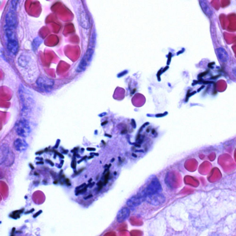 Crystal violet oxalaté de Gram-Hucker