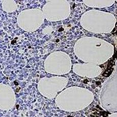 Kit Myéloperoxydase alpha naphtol pyronine