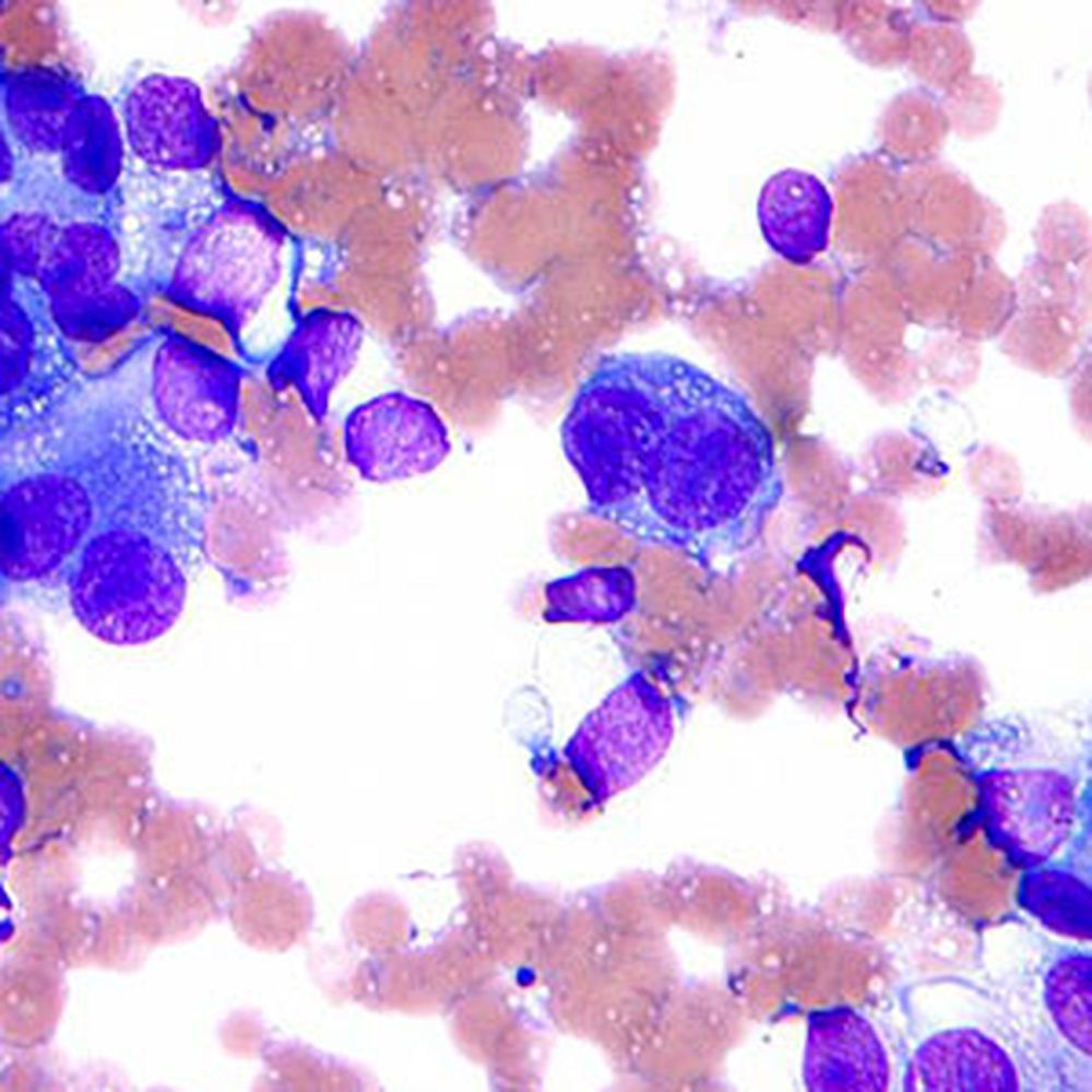 Kit Coloration de Field pour paludisme et hélicobacter pylori