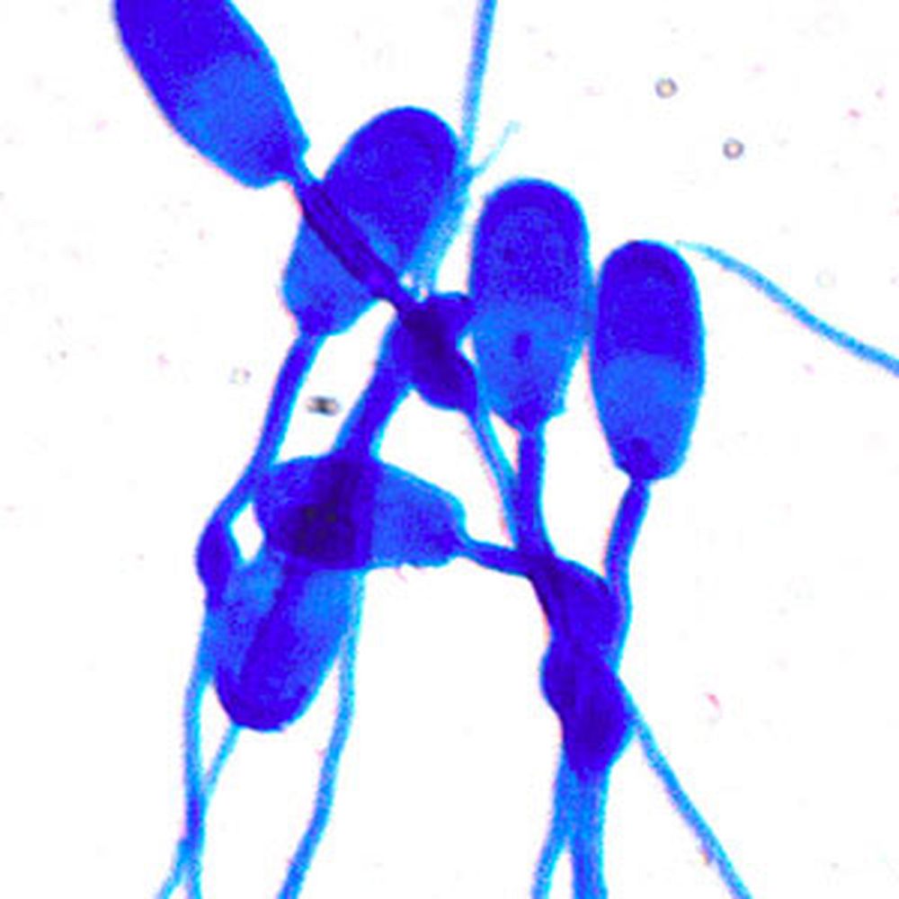 Moti-sperm pour la morphologie des spermatozoïdes