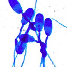 Moti-sperm pour la morphologie des spermatozoïdes