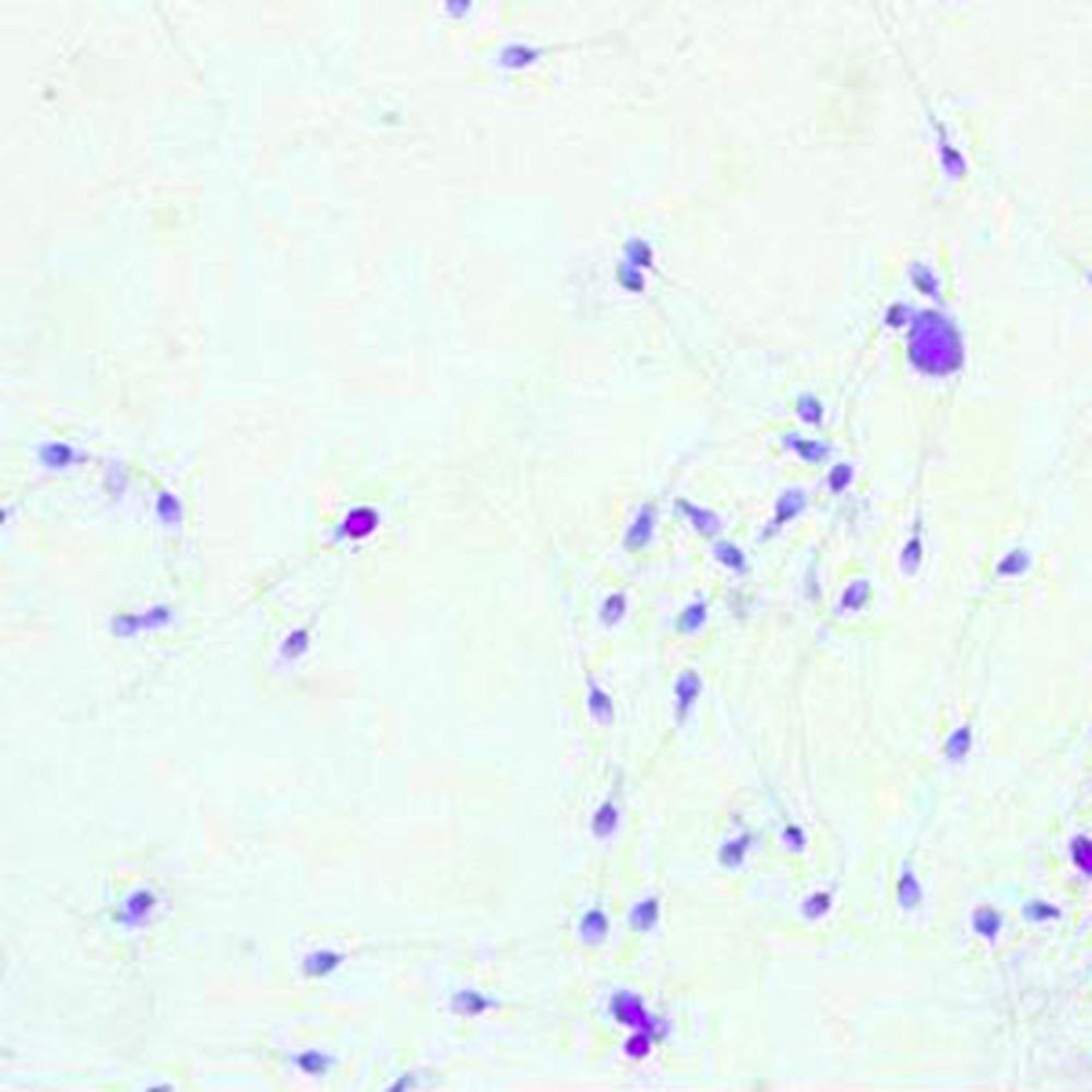 Eosine nigrosine pour la mobilité des spermatozoïdes