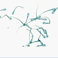 Eosine pour la vitalité des spermatozoïdes