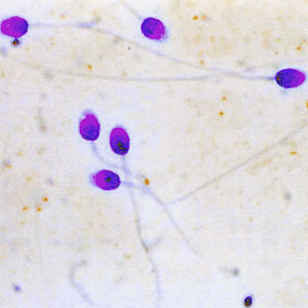 Liscia De Marchi pour morphologie des spermatozoïdes
