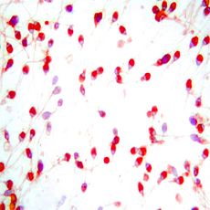 Diluant pour spermatozoïdes
