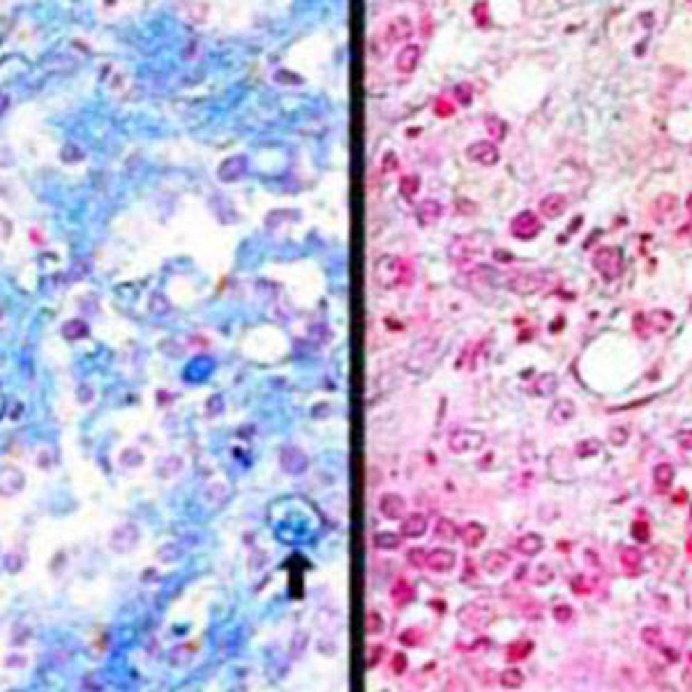 Kit Hyaluronidase, test bovin
