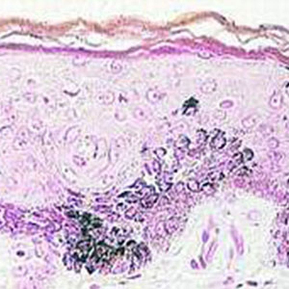 Kit Trichrome de Masson Fontane pour mélanine