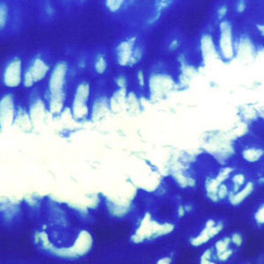 Kit Giemsa pour hélicobacter pylori