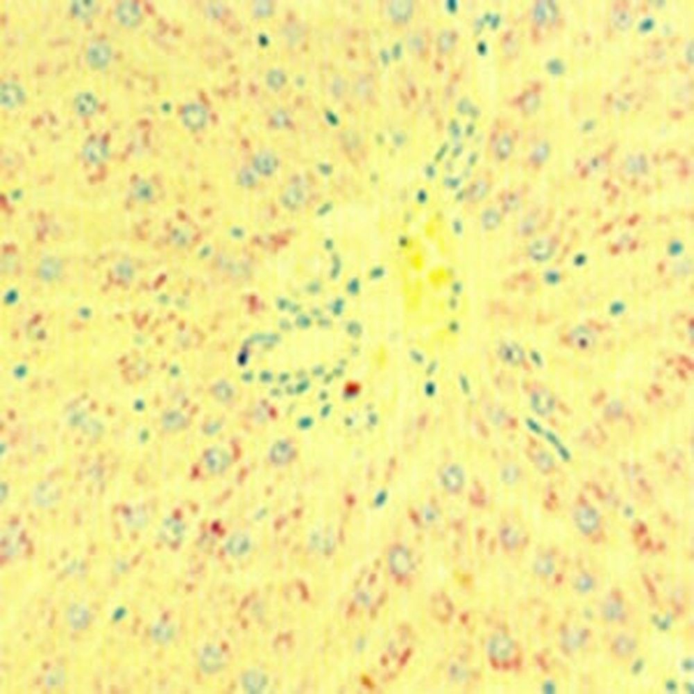 Kit MeÌthyle vert pyronine