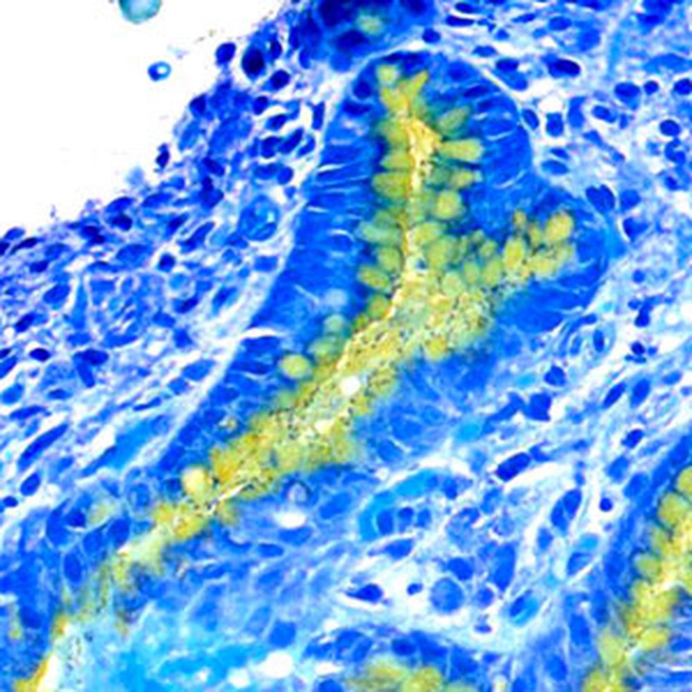 Kit Alcian jaune toluidine bleu