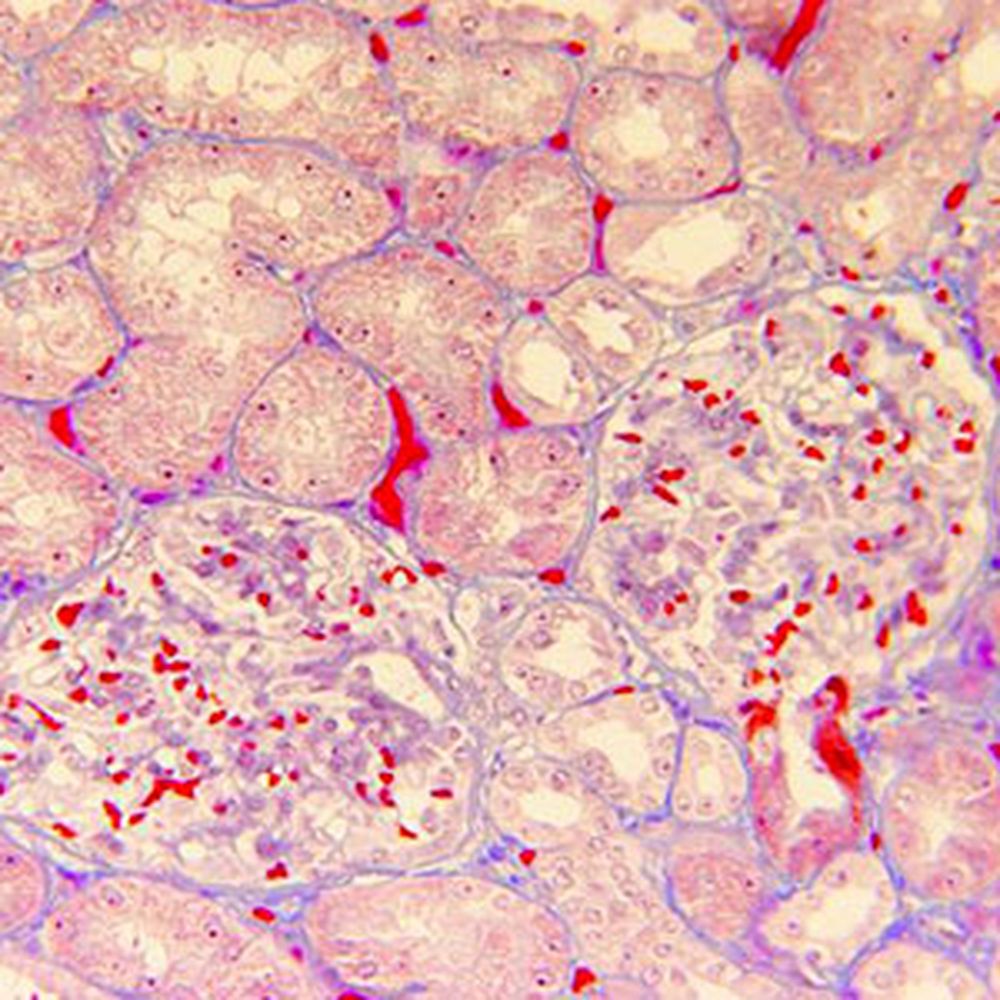 Kit AFOG pour la coloration différentielle des biopsies rénales