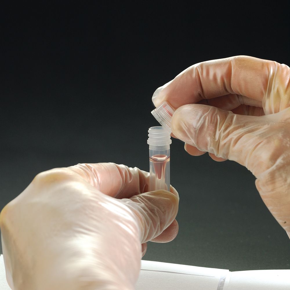 Microtubes, capuchon vissant de sécurité avec filetage externe